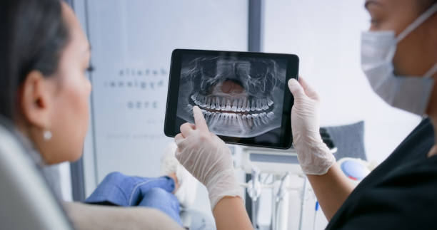 Licensed Teeth Whitening service in Long Beach, CA - Smile Center Dentistry
